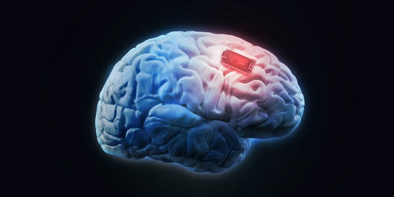 implantes-cerebro